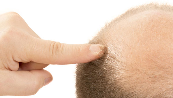 Wirkungsvolle Behandlung für Haarwachstum